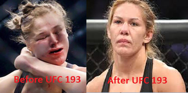 Ronda Rousey Before and After UFC 193