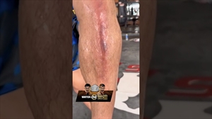 NO PAIN, NO GAIN ?? Can Nong-O defeat Rodtang at The Inner Circle 38?
